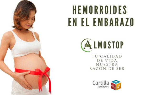HEMORROIDES EN EL EMBARAZO